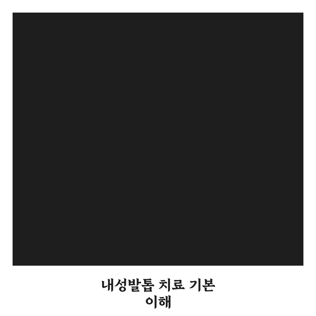 내성발톱 자가치료 5가지 기준별 효과 비교와 선택 가이드